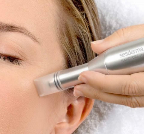 Nanopore tratamiento rejuvenecimieto facial