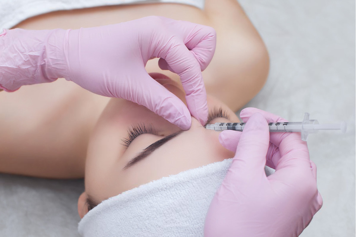 Aplicación de toxina botulínica en el entrecejo para suavizar líneas de expresión.