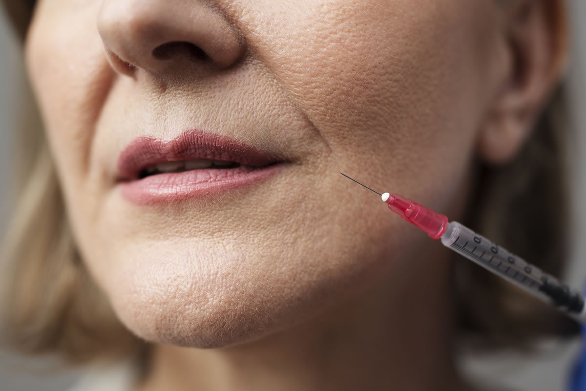 código de barras labios rejuvenecimiento