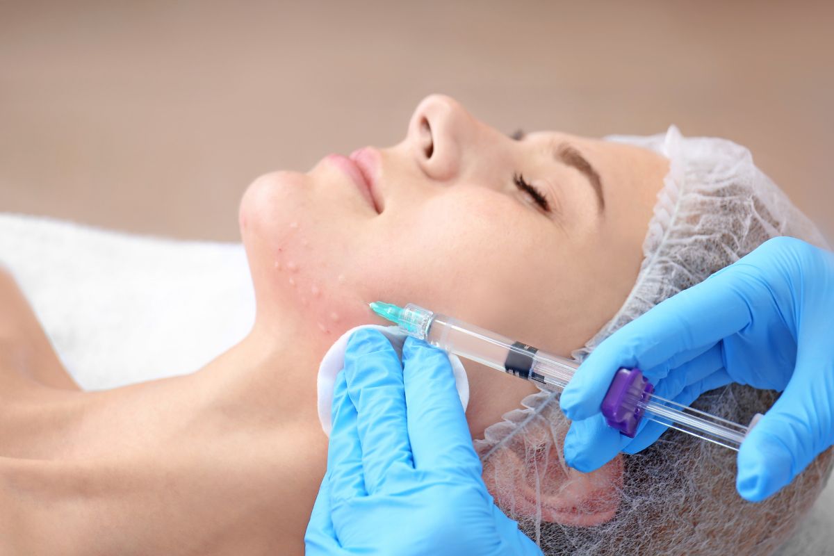 Combined facial rejuvenation with Botox and hyaluronic acid