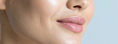 Rostro femenino con armonización facial de aspecto natural y expresión relajada