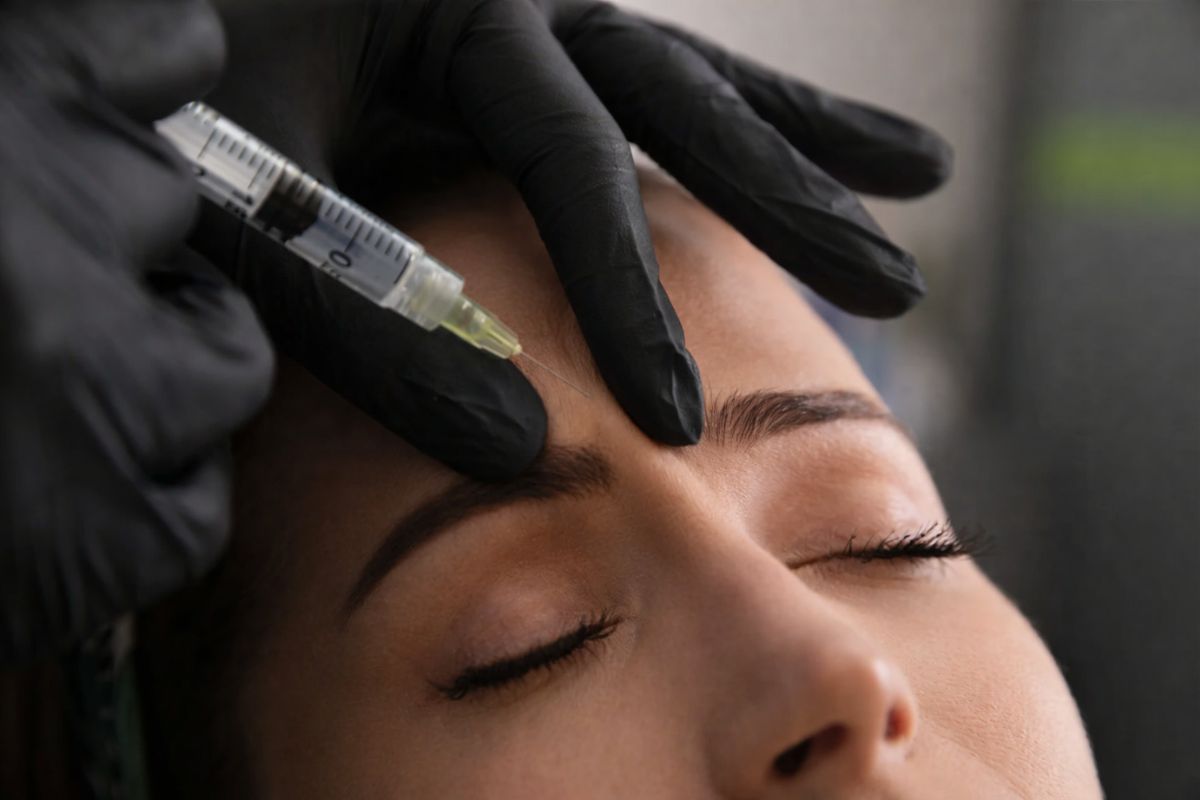 Aplicación de toxina botulínica en la frente para tratar líneas de expresión y arrugas dinámicas del rostro.