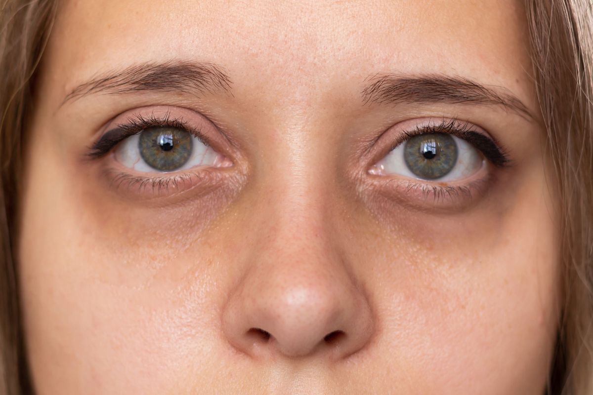 Primer plano del rostro de una mujer con ojeras visibles que muestra cómo el contorno de los ojos influye en la apariencia de cansancio.