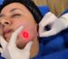 Procedimiento de perfilamiento facial sin cirugía con tecnología Endolift para definir el contorno del rostro.