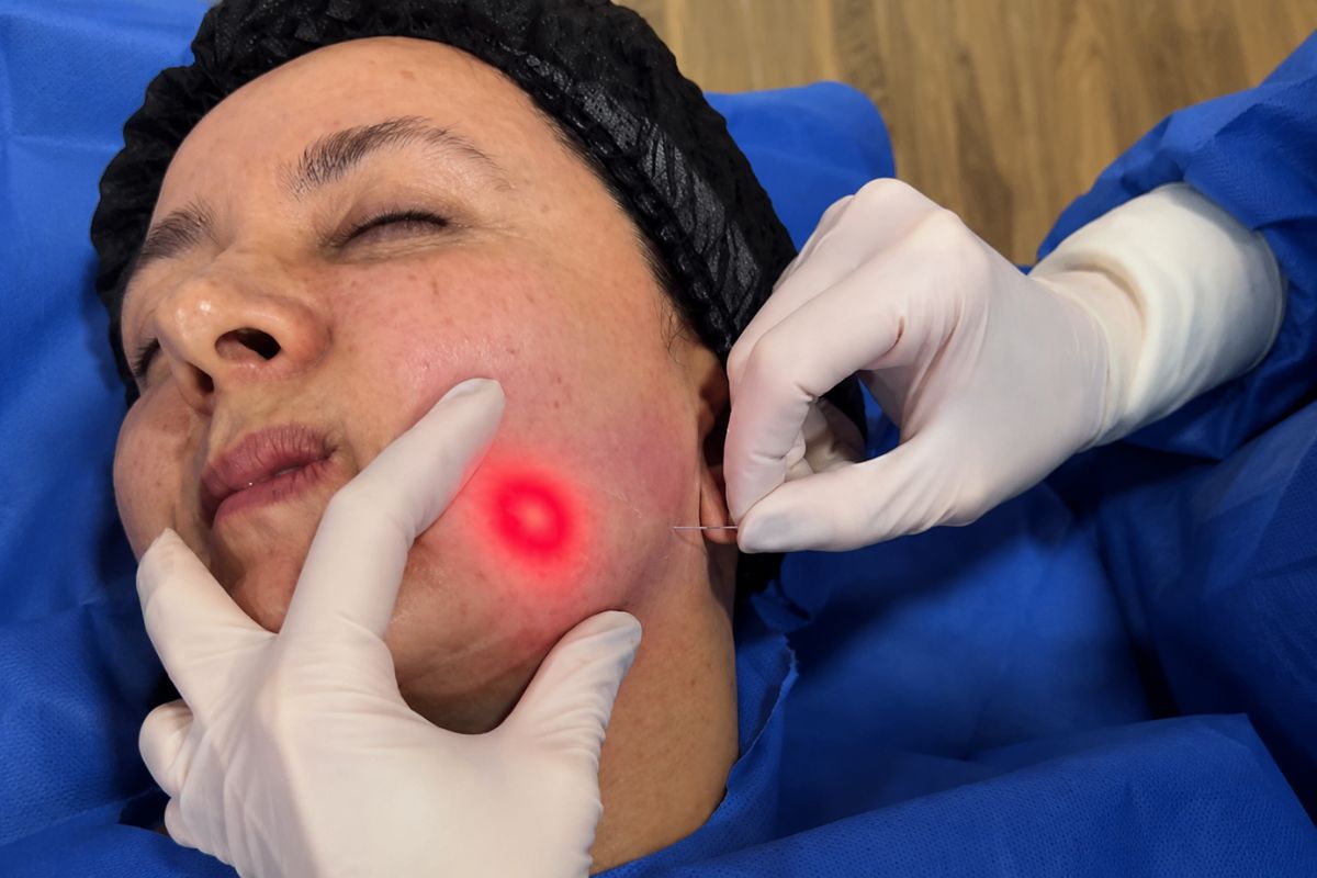 Procedimiento de perfilamiento facial sin cirugía con tecnología Endolift para definir el contorno del rostro.